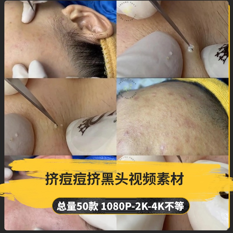 【50款】挤痘痘挤黑头解压视频素材-捷亚素材网