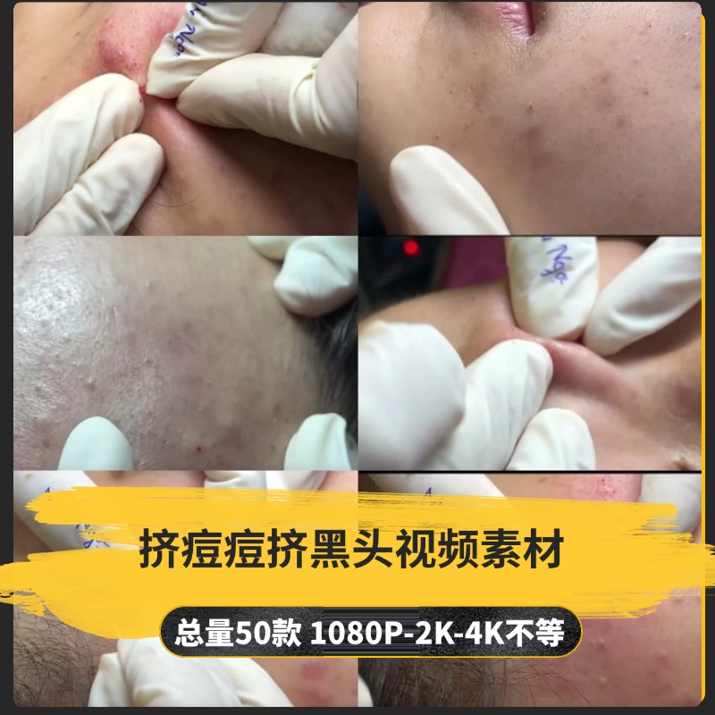 【50款】挤痘痘挤黑头解压视频素材-捷亚素材网