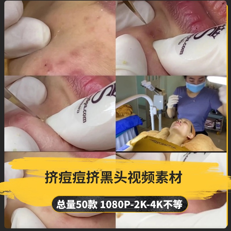 【50款】挤痘痘挤黑头解压视频素材-捷亚素材网